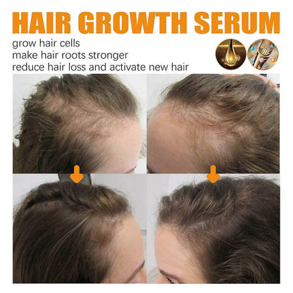 Hair Growth Essential Oil